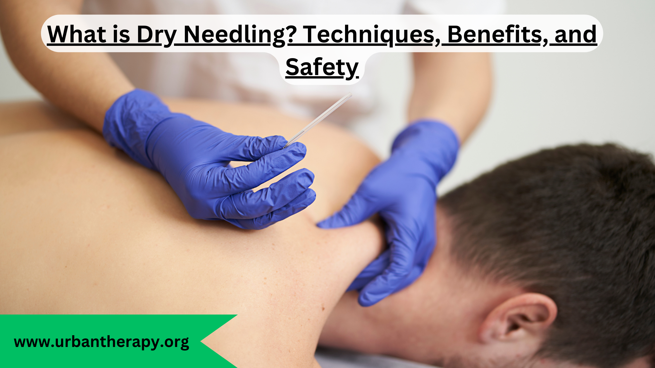 Dry Needling? Techniques, Benefits, and Safety