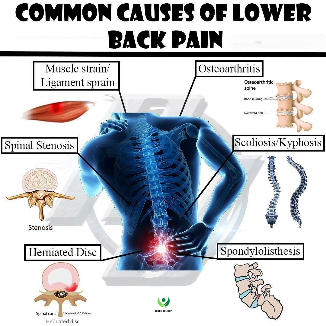 Common Causes of Lower back Pain