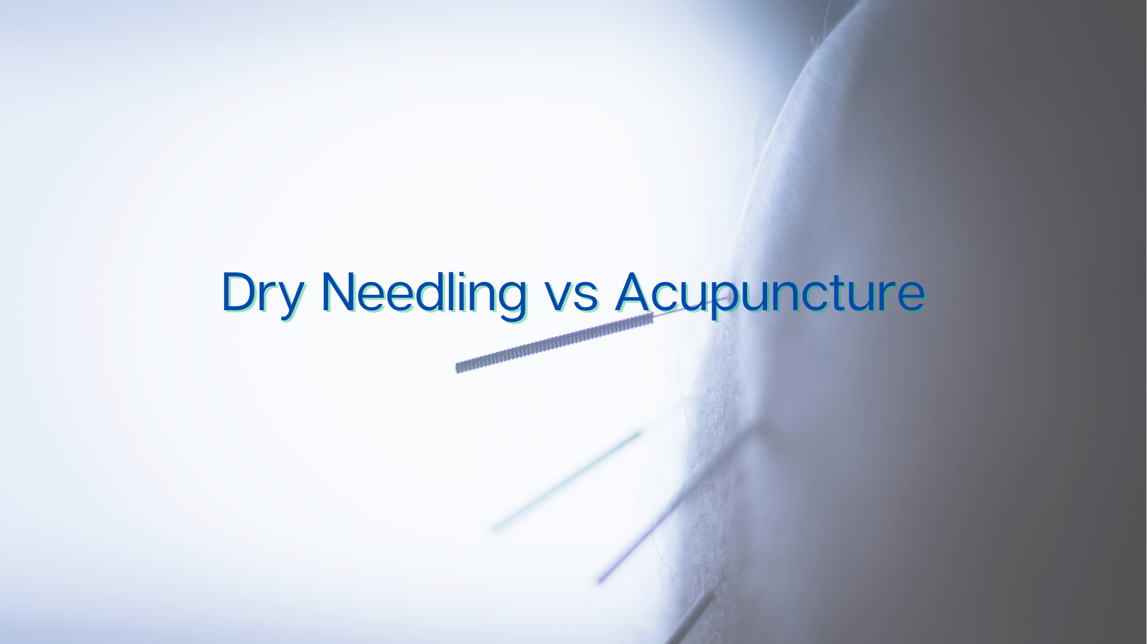 Dry Needling vs Acupuncture